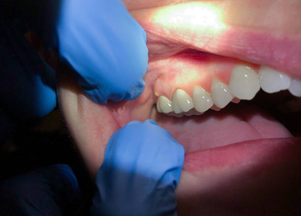 Best Emergency Orthodontic Repairs in Eden Isle, LA